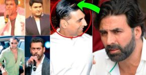Bollywood Celebrities Who Underwent Hair Transplant